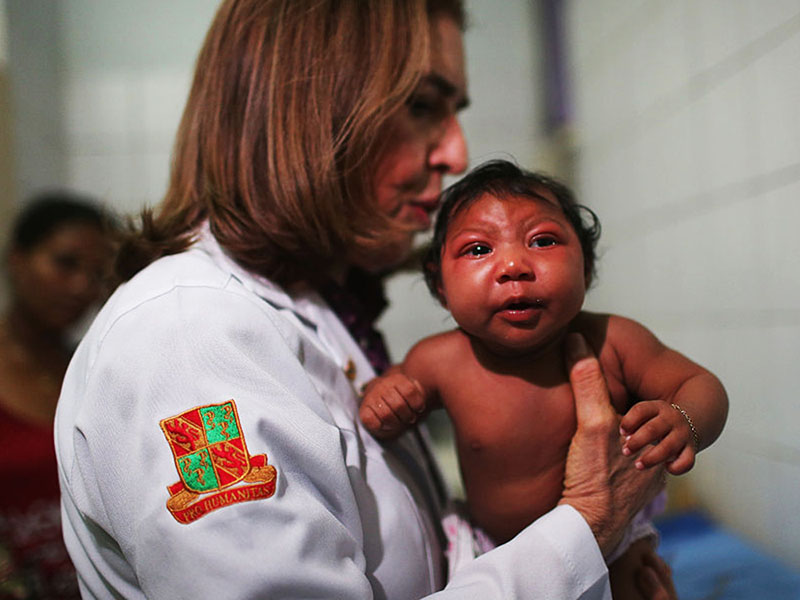 Baby-zu-kleiner-Kopf-wegen-zika-Virus